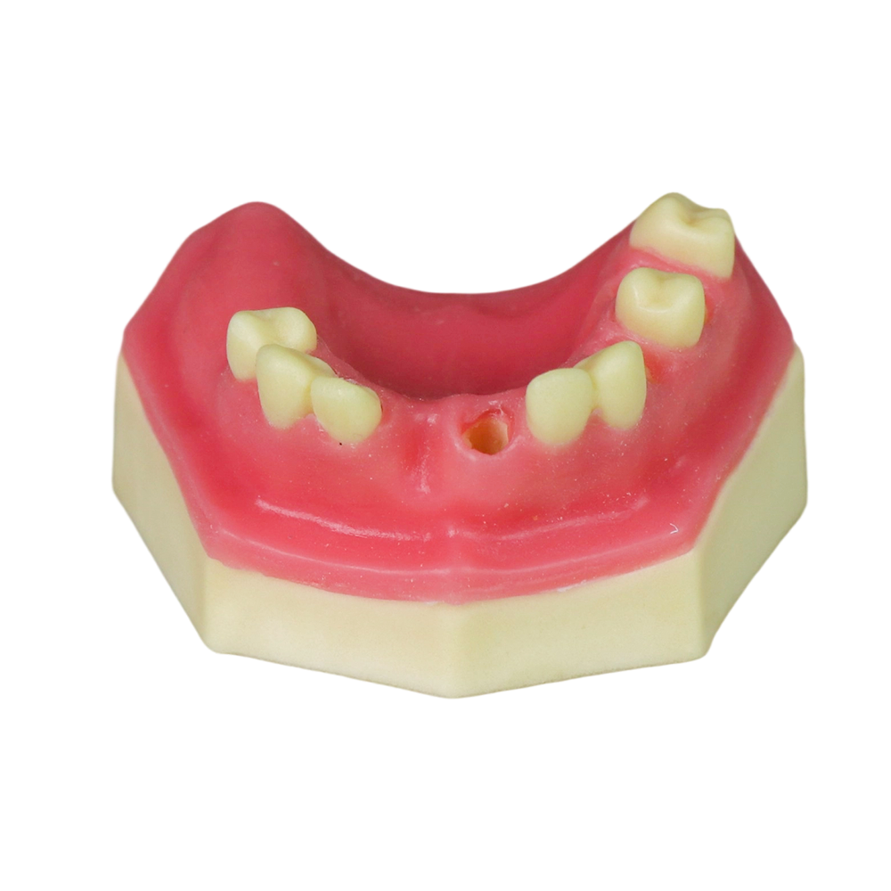 Sinus Lift Dental Model – Hard Resin with Soft Gums for Maxillary Sinus Training JG-Y8-F10