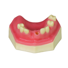 Sinus Lift Dental Model – Hard Resin with Soft Gums for Maxillary Sinus Training JG-Y8-F10