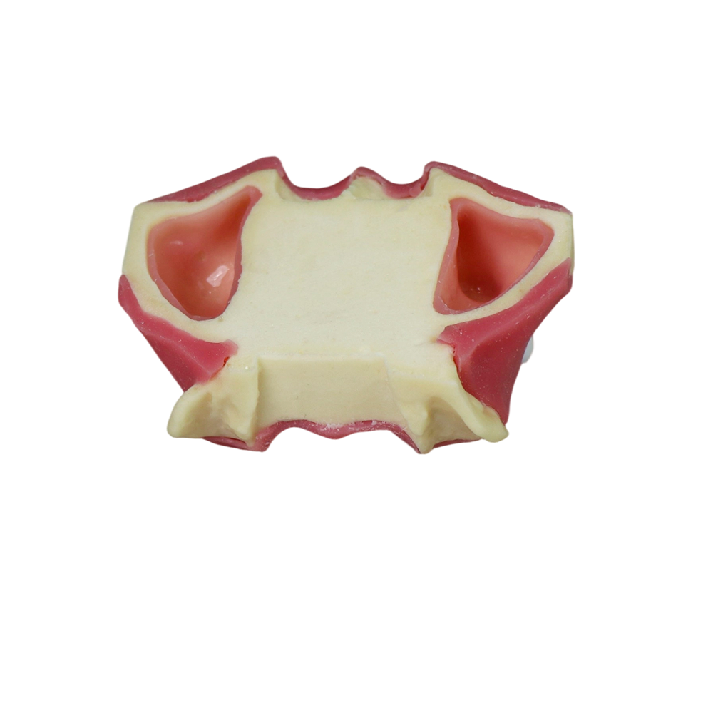 Sinus Lift Dental Model – Hard Resin with Soft Gums for Maxillary Sinus Training JG-Y11-S2