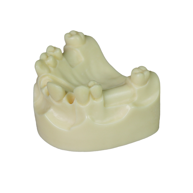 Dental Implant Model – D2 Soft Resin with Gums for Implant Training JG-Y8-F1-4
