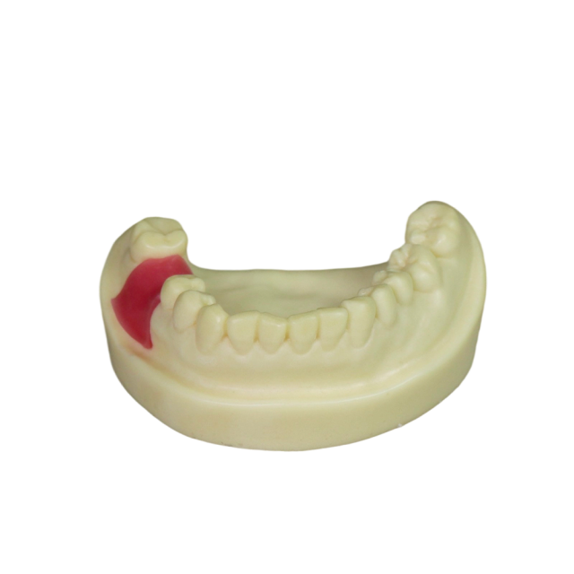 Dental Implant Model – D2 Soft Resin with Gums for Implant Training JG-Y8-F9