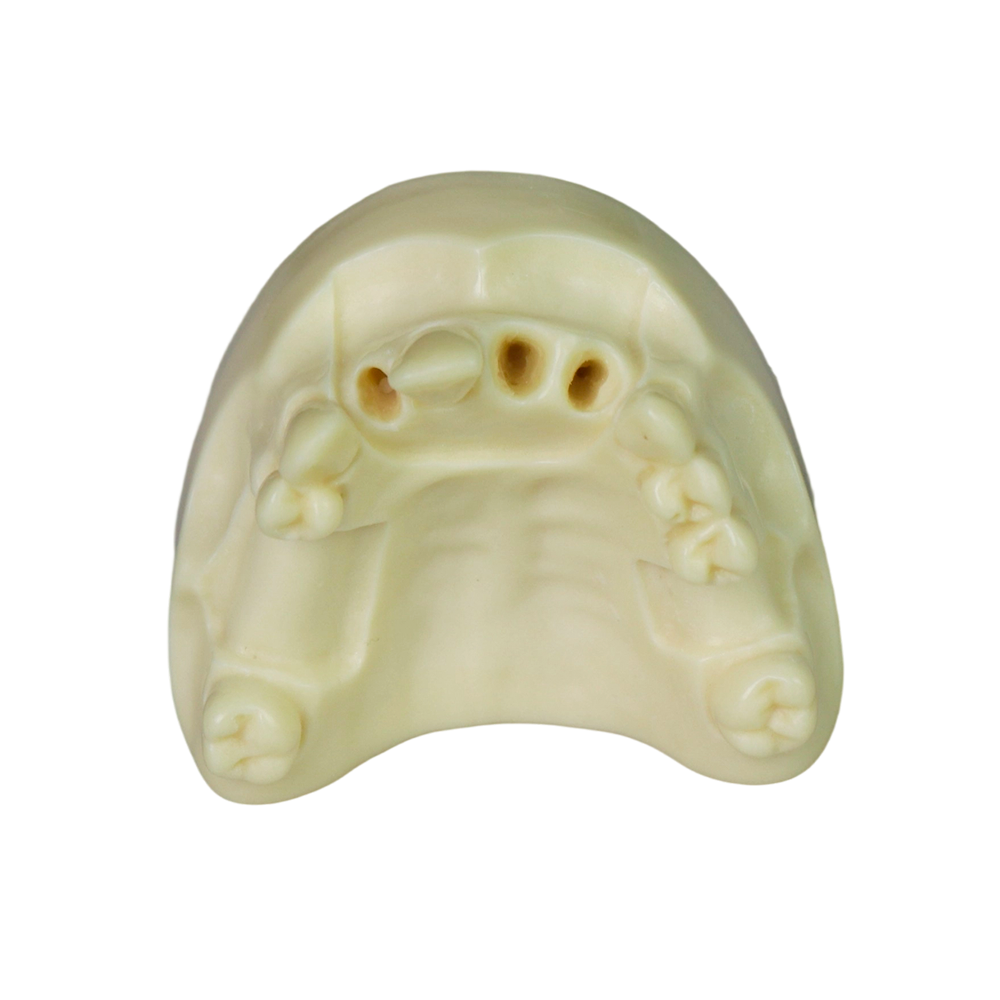 Dental Implant Model – D2 Soft Resin with Gums for Implant Training JG-Y8-F1-4