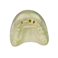 Dental Implant Model – D2 Soft Resin with Gums for Implant Training JG-Y8-F1-4