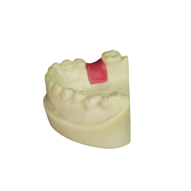 Dental Implant Model – D2 Soft Resin with Gums for Implant Training JG-Y8-F9
