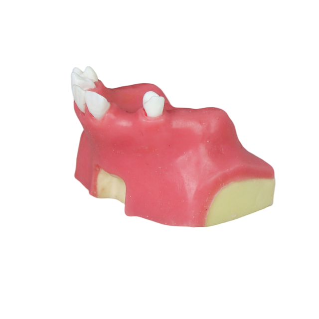 Sinus Lift Dental Model – Hard Resin with Soft Gums for Maxillary Sinus Training JG-Y11-S6