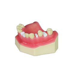 Sinus Lift Dental Model – Hard Resin with Soft Gums for Maxillary Sinus Training JG-Y8-F5