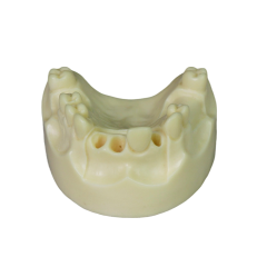 Dental Implant Model – D2 Soft Resin with Gums for Implant Training JG-Y8-F1-4