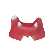 Sinus Lift Dental Model – Hard Resin with Soft Gums for Maxillary Sinus Training JG-YZ-11