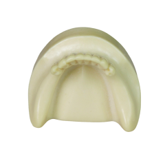 Dental Implant Training Model – Hard Resin with Soft Gum for Implant Practice JG-Y8-F1-6