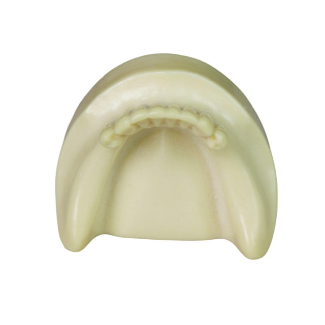 Dental Implant Training Model – Hard Resin with Soft Gum for Implant Practice JG-Y8-F1-6