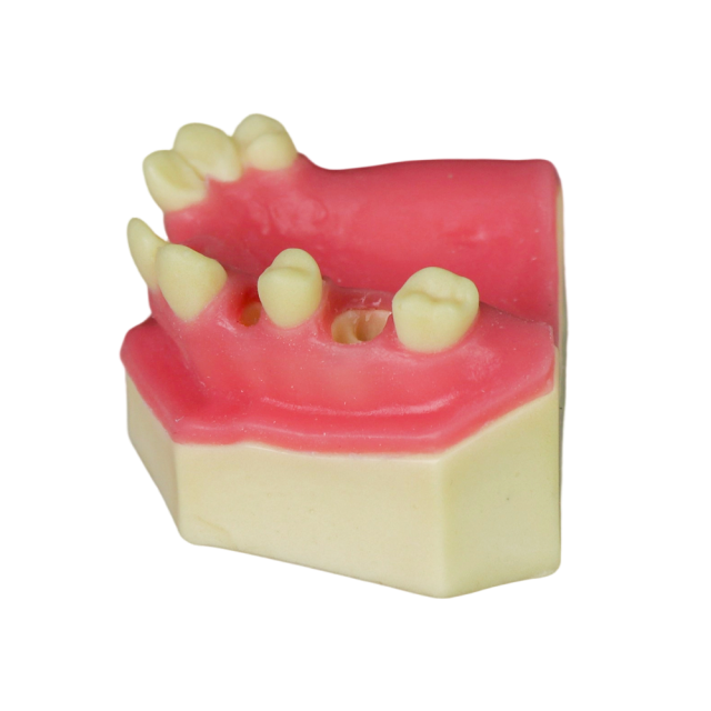 Sinus Lift Dental Model – Hard Resin with Soft Gums for Maxillary Sinus Training JG-Y8-F10