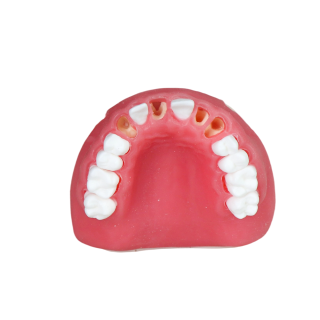 Dental Implant Training Model – Hard Resin with Soft Gum for Implant Practice JG-Y8-F2