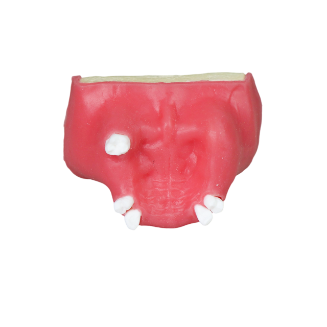 Sinus Lift Dental Model – Hard Resin with Soft Gums for Maxillary Sinus Training JG-Y11-S5