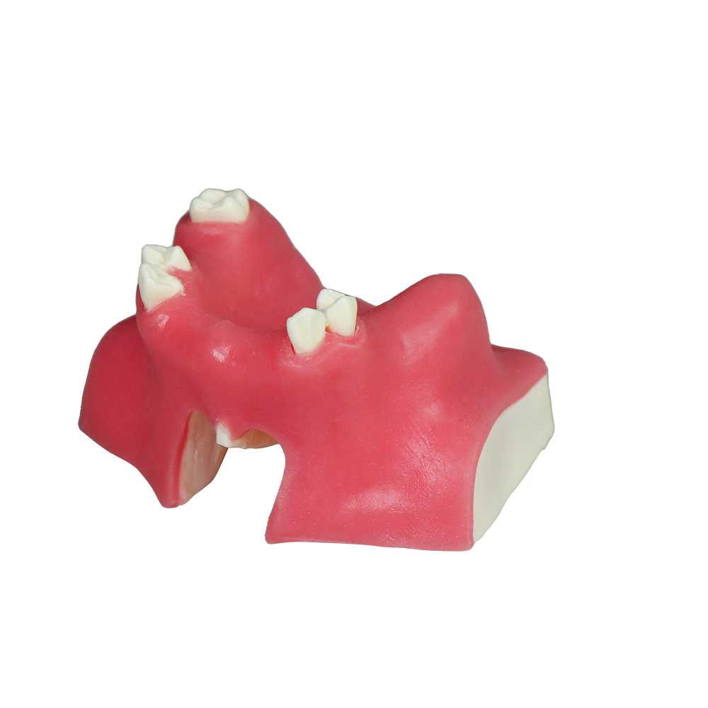 Sinus Lift Dental Model – Hard Resin with Soft Gums for Maxillary Sinus Training JG-Y21