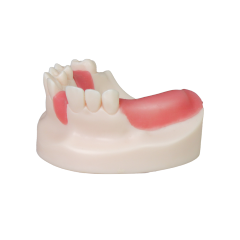 Dental Implant Model – D1 Soft Resin with Gums for Implant Training JG-Y8-F6