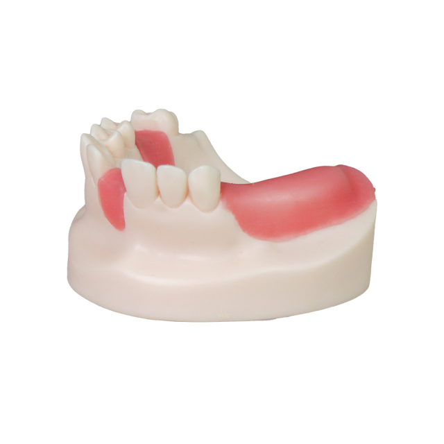 Dental Implant Model – D1 Soft Resin with Gums for Implant Training JG-Y8-F6