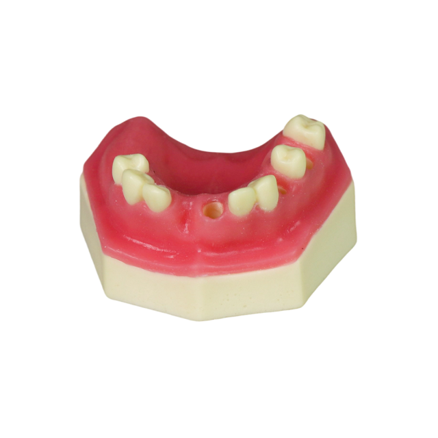 Fast Implant Dental Model – Soft Resin and Soft Gums for Implant Training JG-YZ-15
