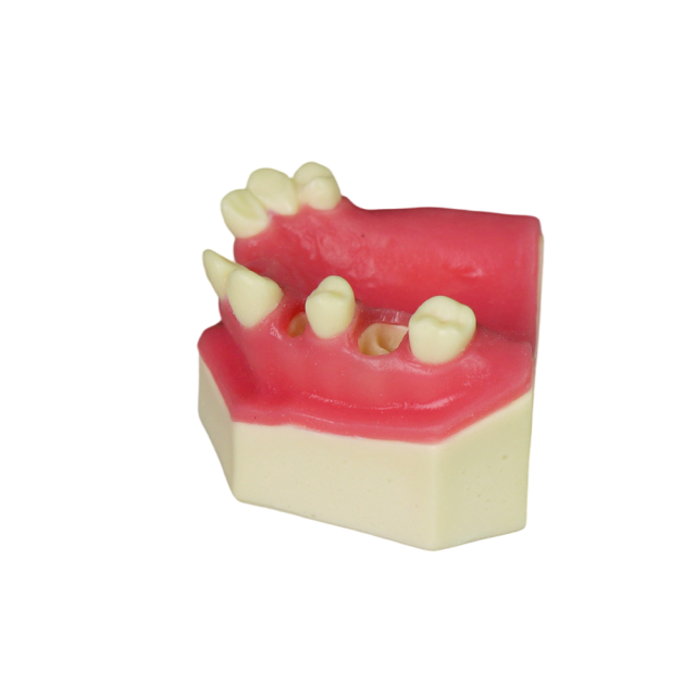 Fast Implant Dental Model – Soft Resin and Soft Gums for Implant Training JG-YZ-15