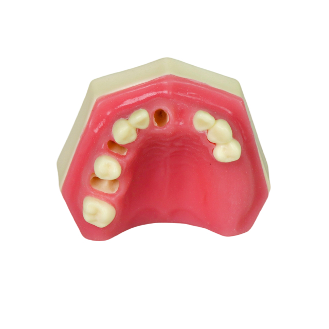 Fast Implant Dental Model – Soft Resin and Soft Gums for Implant Training JG-YZ-15