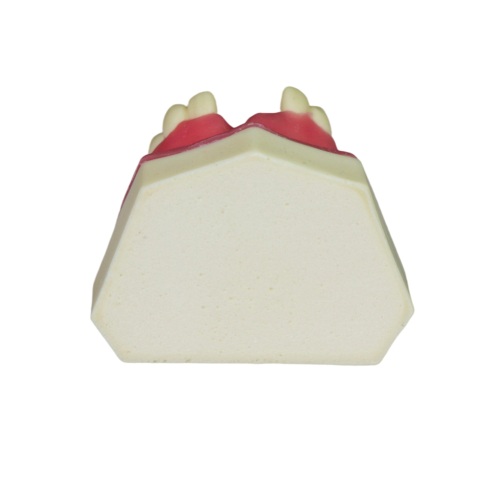 Fast Implant Dental Model – Soft Resin and Soft Gums for Implant Training JG-YZ-15