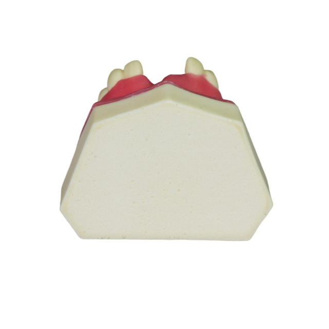 Fast Implant Dental Model – Soft Resin and Soft Gums for Implant Training JG-YZ-15