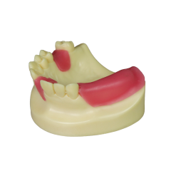 Fast Implant Dental Model – Soft Resin and Soft Gums for Implant Training JG-Y8-F11