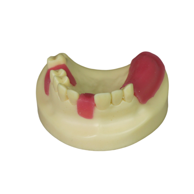 Fast Implant Dental Model – Soft Resin and Soft Gums for Implant Training JG-Y8-F11