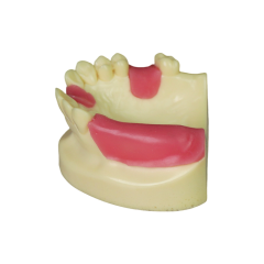 Fast Implant Dental Model – Soft Resin and Soft Gums for Implant Training JG-Y8-F11