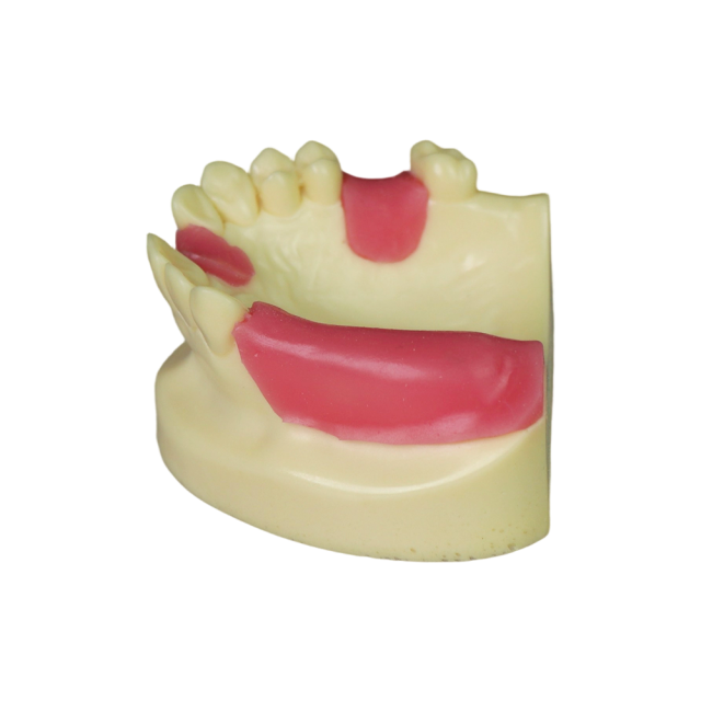 Fast Implant Dental Model – Soft Resin and Soft Gums for Implant Training JG-Y8-F11