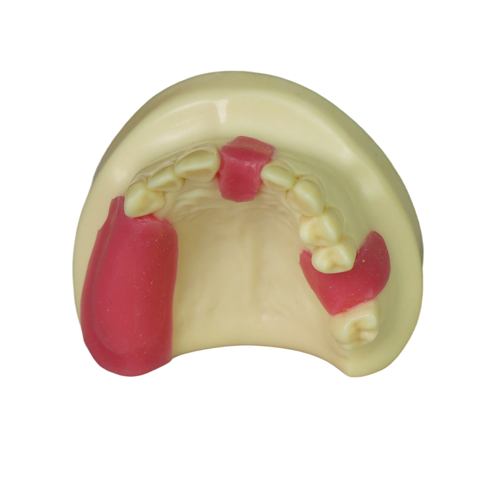 Fast Implant Dental Model – Soft Resin and Soft Gums for Implant Training JG-Y8-F11