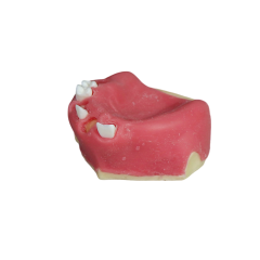Fast Implant Dental Model – Soft Resin and Soft Gums for Implant Training JG-Y26-2