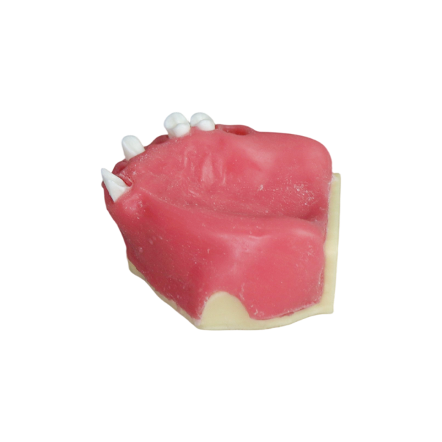 Fast Implant Dental Model – Soft Resin and Soft Gums for Implant Training JG-Y26-2