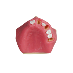 Fast Implant Dental Model – Soft Resin and Soft Gums for Implant Training JG-Y26-2