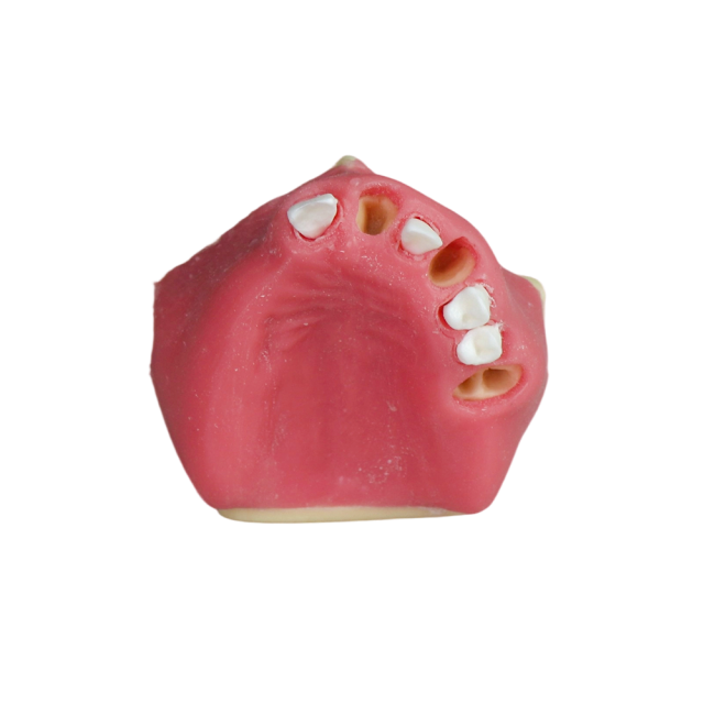 Fast Implant Dental Model – Soft Resin and Soft Gums for Implant Training JG-Y26-2