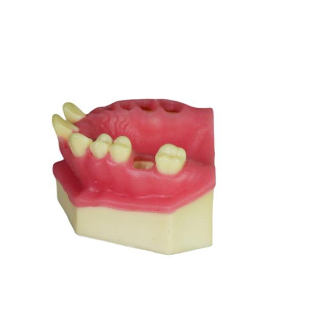 Fast Implant Dental Model – Soft Resin and Soft Gums for Implant Training JG-Y8-F3