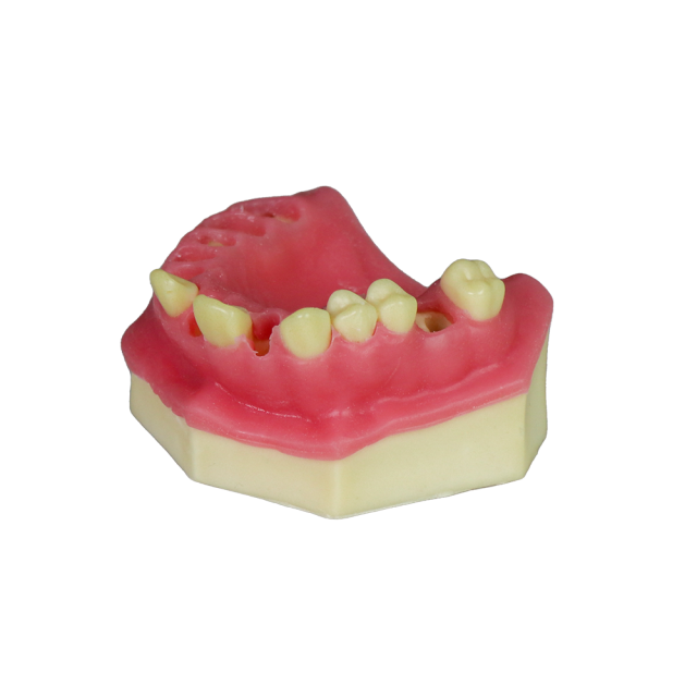 Fast Implant Dental Model – Soft Resin and Soft Gums for Implant Training JG-Y8-F3