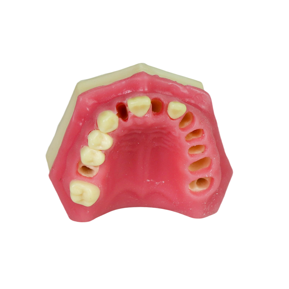 Fast Implant Dental Model – Soft Resin and Soft Gums for Implant Training JG-Y8-F3
