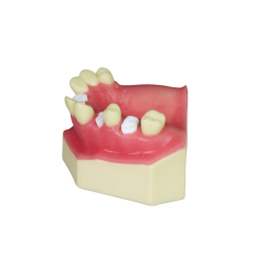Sinus Lift Dental Model – Hard Resin with Soft Gums for Maxillary Sinus Training JG-Y8-F5