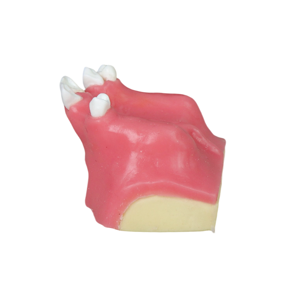 Sinus Lift Dental Model – Hard Resin with Soft Gums for Maxillary Sinus Training JG-Y11-S6
