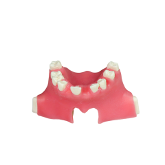 Sinus Lift Dental Model – Hard Resin with Soft Gums for Maxillary Sinus Training JG-Y11-S1