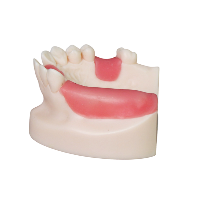 Dental Implant Model – D1 Soft Resin with Gums for Implant Training JG-Y8-F6