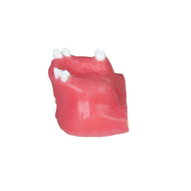 Sinus Lift Dental Model – Hard Resin with Soft Gums for Maxillary Sinus Training JG-Y11-S5