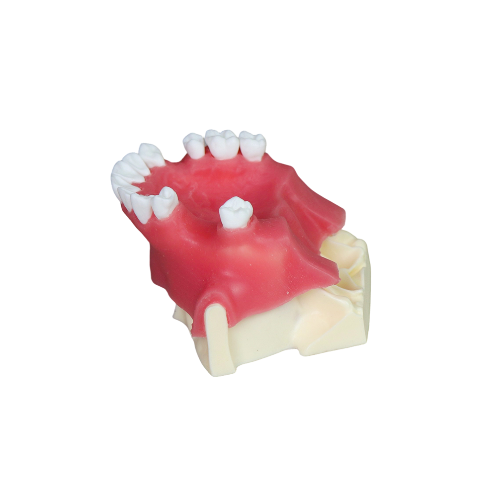 Sinus Lift Dental Model – Hard Resin with Soft Gums for Maxillary Sinus Training JG-Y26