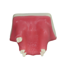 Sinus Lift Dental Model – Hard Resin with Soft Gums for Maxillary Sinus Training JG-Y21