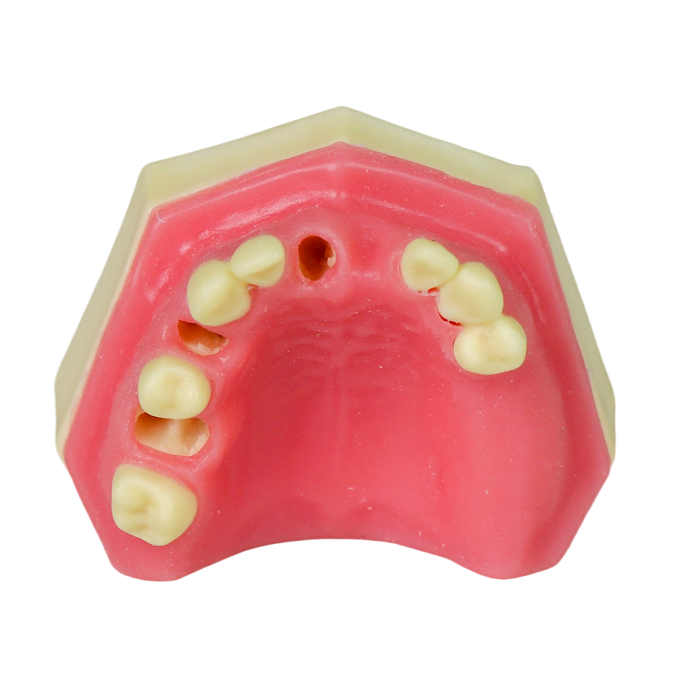 Sinus Lift Dental Model – Hard Resin with Soft Gums for Maxillary Sinus Training JG-Y8-F10