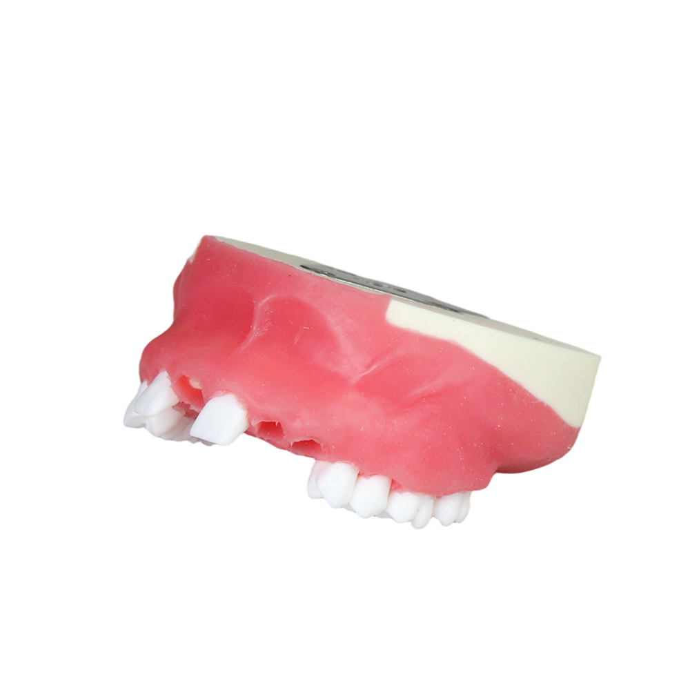 Dental Implant Training Model – Hard Resin with Soft Gum for Implant Practice JG-Y8-F2