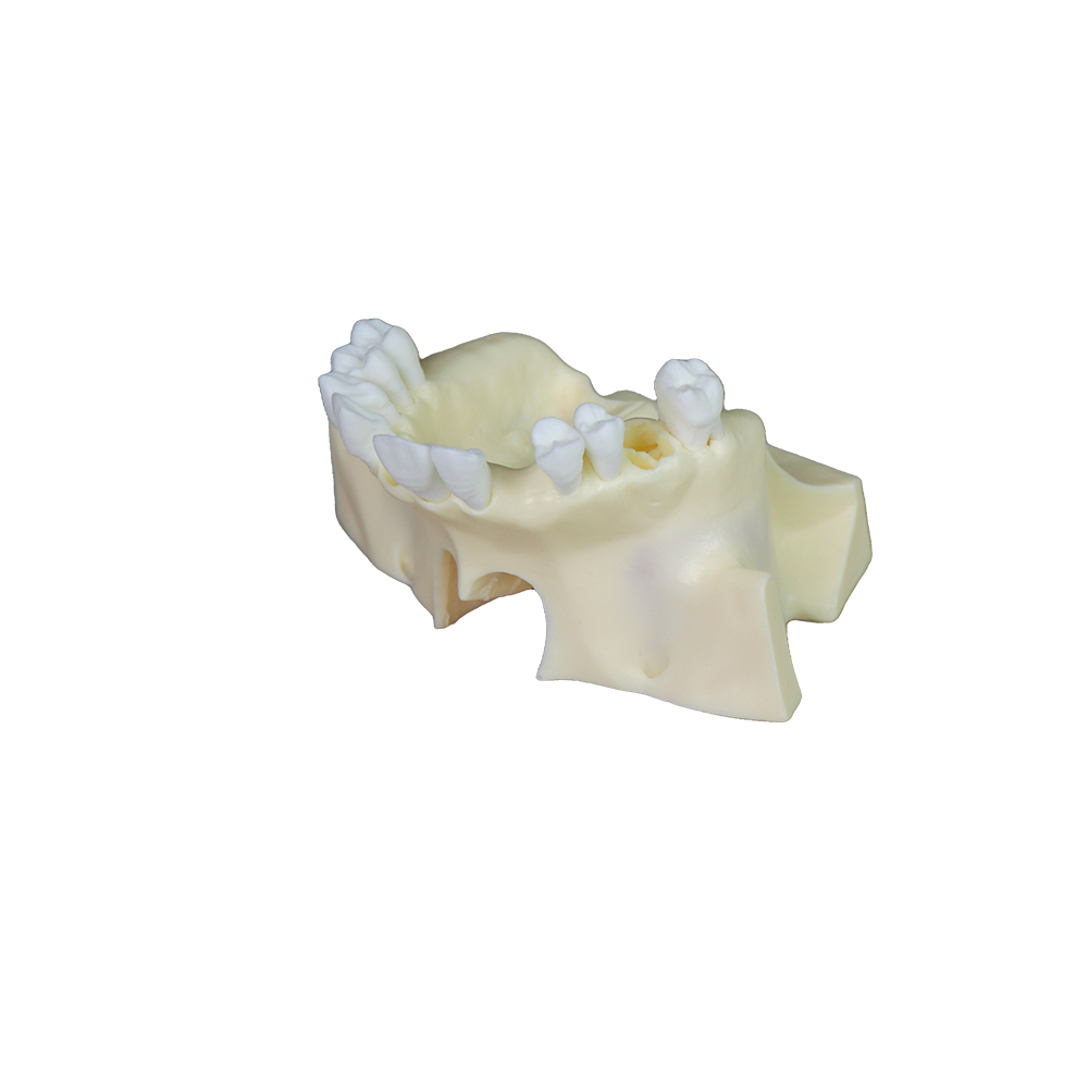 Sinus Lift Dental Model – Hard Resin with Soft Gums for Maxillary Sinus Training JG-Y11-S1-1