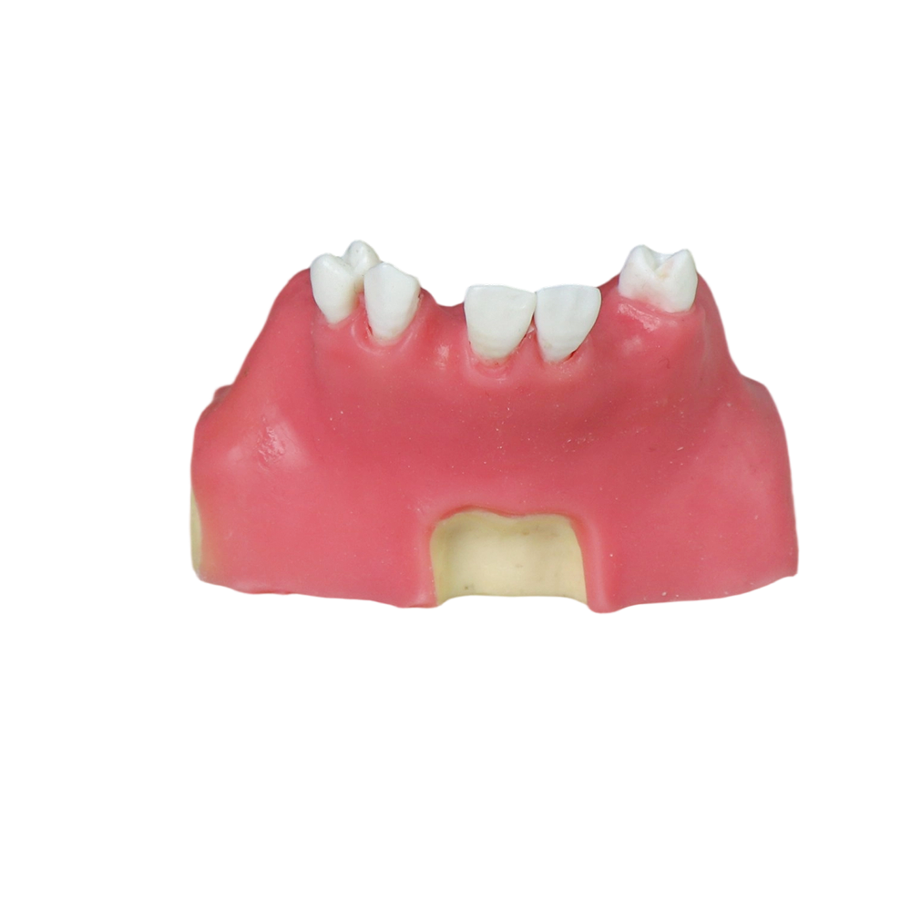 Sinus Lift Dental Model – Hard Resin with Soft Gums for Maxillary Sinus Training JG-Y11-S6