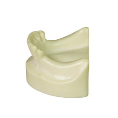 Dental Implant Training Model – Hard Resin with Soft Gum for Implant Practice JG-Y8-F1-6
