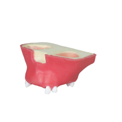 Sinus Lift Dental Model – Hard Resin with Soft Gums for Maxillary Sinus Training JG-Y11-S5